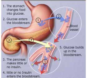 Medicine Acupuncture Herbal Treatment Cure Diabetes Kuala Lumpur Herbs Medical Treatment Cure Centre