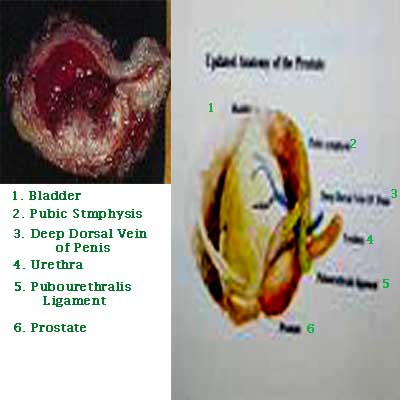 Medicine Acupuncture Herbal Treatment Cure Bladder Cancer Kuala Lumpur Herbs Medical Treatment Cure Centre